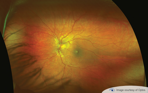 A retina close up